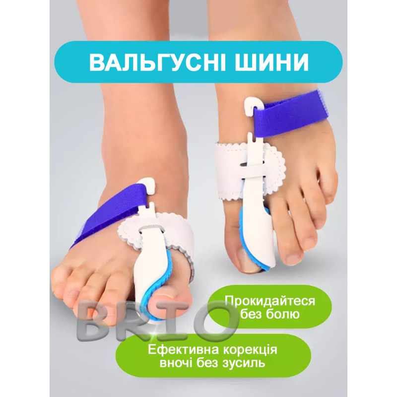 Нічний вальгусний бандаж — коректор "кісточки" (ортез)
