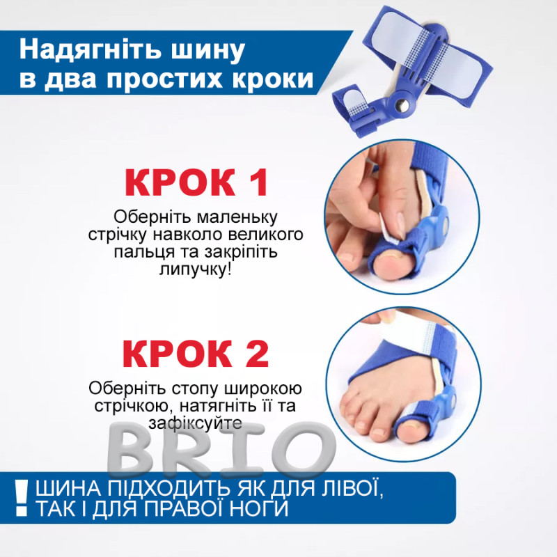 Шарнірний вальгусний бандаж — коректор "кісточки" для ходьби