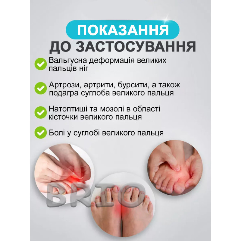Нічний вальгусний бандаж — коректор "кісточки" (ортез)
