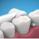 Насадка Power Tip Care на зубну щітку Oral-B для брекетів набір 4 шт