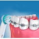Змінні насадки Ortho Care для зубної щітки Oral-B для брекет-систем OD17-2 4 шт