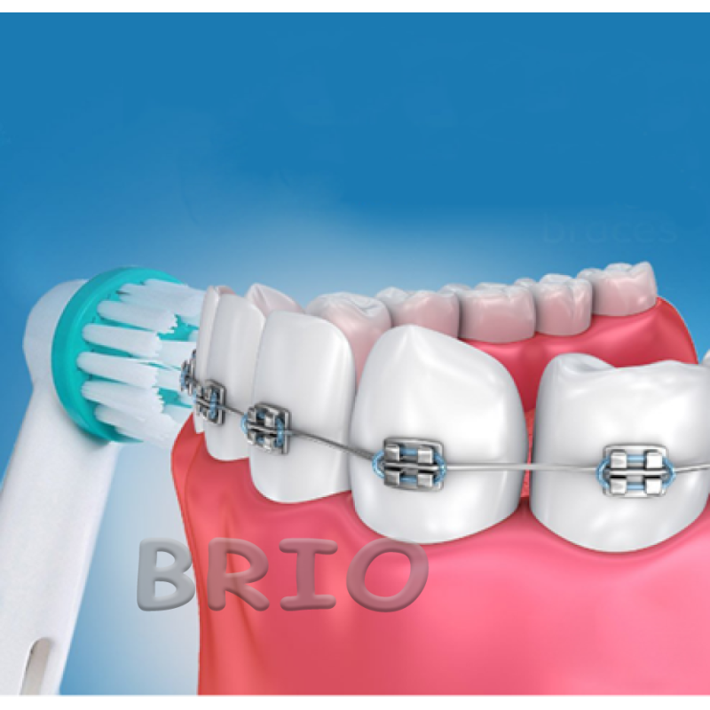 Змінні насадки Ortho Care для зубної щітки Oral-B для брекет-систем OD17-2 4 шт